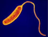 Cholera causing bacteria